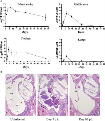 Adaptive immune protection of the middle ears differs from that of the respiratory tract